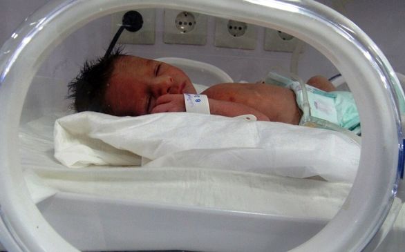 سزارین مناسبتی باعث ایجاد اختلالات تنفسی برای نوزاد میشود