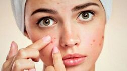  صورتتان درباره سلامتی شما چه می گوید؟ 
