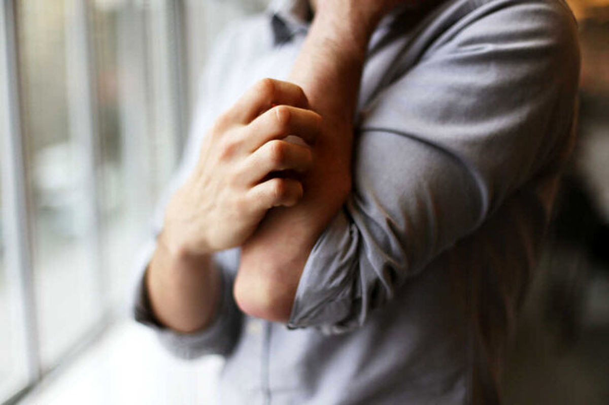 چرا خاراندن، خارش مزمن را بدتر میکند؟