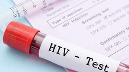 داروهای HIV خطر انتقال ایدز را تقریباً به صفر می رسانند