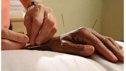 سرطان پروستات با طب سوزنی مهار می شود